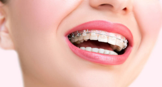 Болят зубы после лечения кариеса — ноют зубные органы