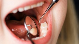 Удаление зуба мудрости взрослому: показания к операции и ее особенности